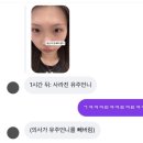 블리비의원 | [내돈내산] 동탄 블리비의원 점 제거 후기