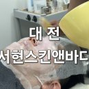 강화농업협동조합송해지점 | 깨끗하고 환한 피부의 시작! 대전 대동 피부관리, 서현스킨앤바디 모공세척관리 후기!