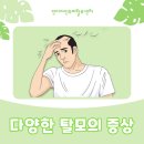 인디자인두피탈모