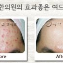 피브로한의원 이미지