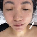 뷰디 | 일산 피부관리 추천 뷰티더위드 룩서스 리프팅관리 대만족후기