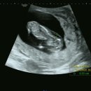 윤은숙산부인과의원 이미지