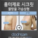 송재용 | 강남 물방울가슴 전후후기 겨드랑이절개가슴수술후기 두드림 송재용원장님