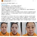 (주)솜바이오 | 【마스크팩추천】 피부 타입별 SUSORO 수소 마스크팩 리얼 후기 대공개