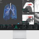 라인소프트 이미지