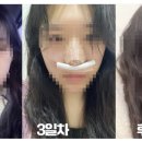 서울퀸성형외과의원 이미지