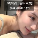 여기가음주가무 | 사각턱보톡스 효과 제오민 2주차 내돈내산 후기