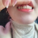 예신치과기공소 | 앞니 메이크오버, 예비신부님 앞니 성형 이쁘게 지르코니아 크라운