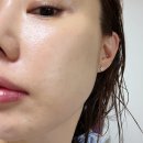 이진스킨케어 - 강동구 구천면로98길 5 | 청담동 피부과 줄기세포주사 가격, 2주차 솔직후기