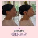 더예뻐지는샵 - 노원구 동일로195길 7 | 광주북구리프팅 고민 끝! 북구예뻐지는샵 온다웨이브 관리 솔직후기