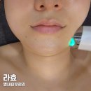 34 | 라효 별내피부관리 맞춤 에스테틱 추천 후기