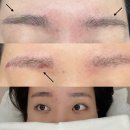 [내돈내산] 광양 중마동 안아픈 눈썹잔흔제거 &amp; 눈썹문신 &lt;송블레스&gt; 솔직 만족후기