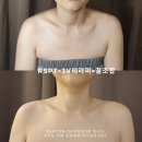 피부의정석