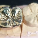 지안치과기공소 이미지