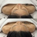 조동길 | 사천피부관리 제대로 느낀 날, 에비뉴에스테틱 첫 방문 후기