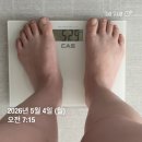 더멍 | [인천 팔뚝 무한람스 리얼 후기] 멍, 통증, 람스 둘레 3개월 변화 후기(이걸로 총정리)
