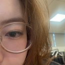 선장가스 | 서울성모병원 20대 망막박리 수술후기 (공막돌륭술)👀