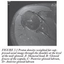 MRI : Bony Pelvis, Knee, Shoulder & Elbow - 기초가 중요하다는 걸 보여주는 자료 이미지