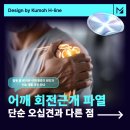 코리아정형외과의원 | 정왕정형외과, 어깨 회전근개 파열, 단순 오십견과 다른 점