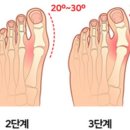 아마레필라테스