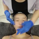 아리움 | 창원 슈퍼젝션 전문 | 아리움 슈퍼젝션 솔직 후기
