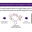 업브레인 이미지