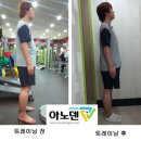 아노덴