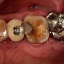 엔도코어 이미지