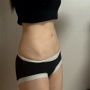 러브라인 | 인천 하프컷 5주차 최종후기 | 러브핸들 정리되고 복근라인까지