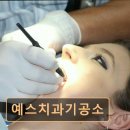 예스치과기공소 네이버블로그
