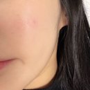 디자인팜스 | 팜스아이비씨 앰플 100 가로 세로 모공 콜라겐 앰플 임상 솔직 후기