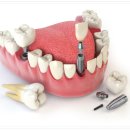 성광치과의원 이미지