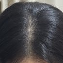 올영 세일 추천템 | 라보에이치 헤어라인앰플 (15ML 더블기획) | 탈모앰플 | 두피앰플 | 내돈내산