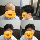 프리위그