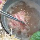 부천김안과내