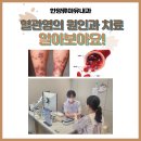 한양류마유내과의원 | 동탄 혈관염 자반 홍반 잘 보는 병원