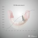 나비덴탈 이미지