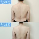 여헌로-5 | 구미피부관리 추천! 더에스테틱온 등라인 전체 케어로 매끈한 뒤태 완성한 후기