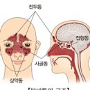 축농증 원인 (부비동염) 이미지