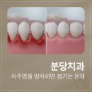 분당치과, 치주염을 방치하면 생기는 문제
