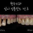 미소천사치과의원 이미지