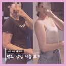 방이코끼리약국 | 대전 팔뚝 람스 수술당일 생생 리얼 후기 그리고 꿀팁 (긴글 주의)