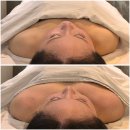 JH 메디 | 윤슬테라피 JH윤곽술 받고 볼륨감 생긴 얼굴 효과/라운드숄더 개선했어요/미라클jh메디프로로 얼굴균형잡기