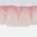 광테크치과기공소 이미지