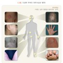 서혜환경 네이버블로그