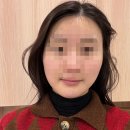 오편한 의원 | 수원 인계동 리프팅 추천 세모아의원 티타늄리프팅 슬림핏윤곽주사 솔직후기