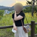멍발란스 | 분당 팔뚝무한람스 3주차 후기, 붓기, 멍, 라인 변화까지 솔직하게 정리