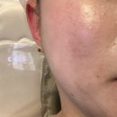 솔샘유치원 | 인천 주안 간석동 피부관리 잘하는 곳 유솜스킨에서 보습 진정관리 받고 왔어요