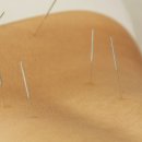 침산한의원 이미지