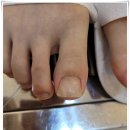 페디네일 이미지